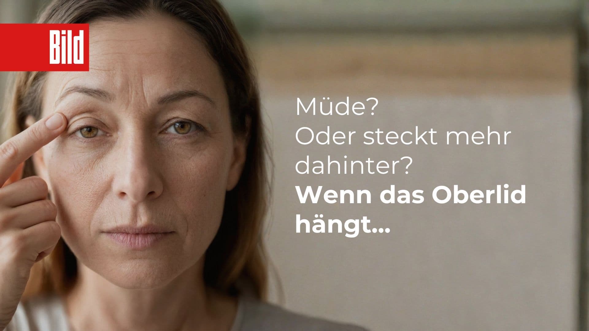 Frau hebt Oberlid mit Finger an, Blogbeitrag über hängende Oberlieder und Schlupflid-Korrektur