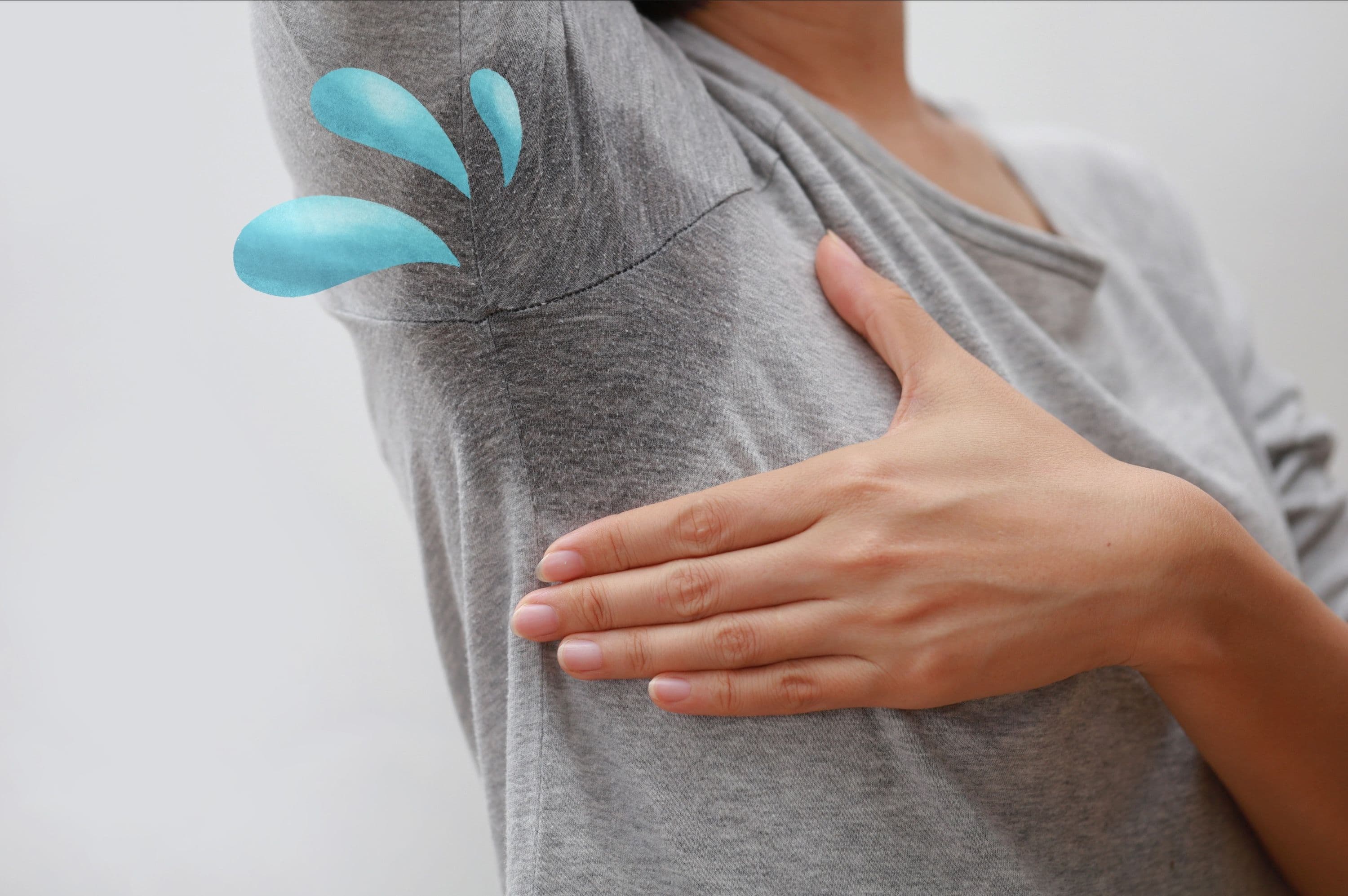 Schluss mit Schwitzen: Botulinumtoxin A gegen Hyperhidrose