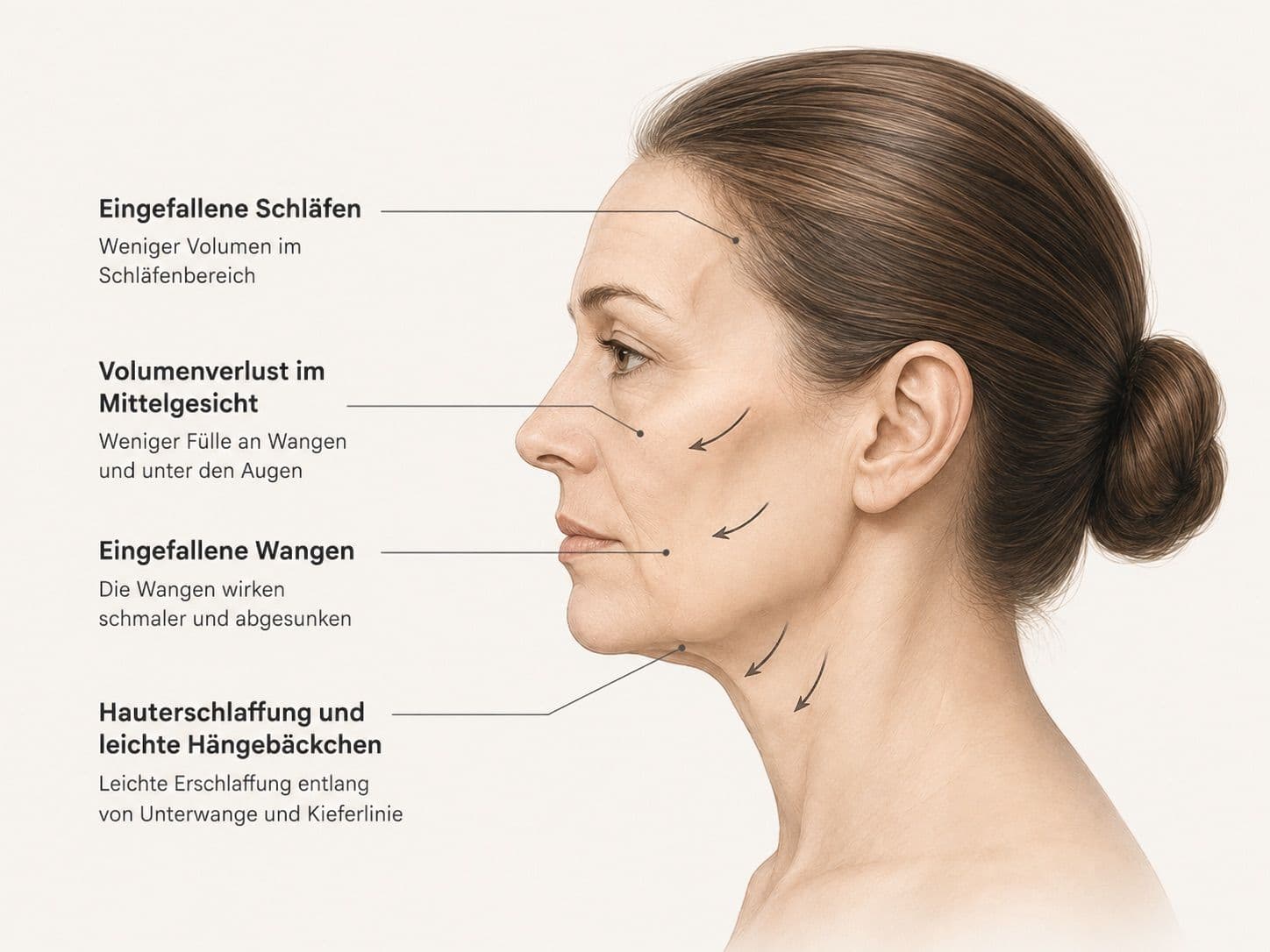 Ozempic-Face-Map.jpeg