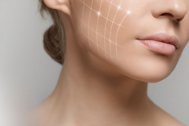 Frauengesicht im Profil mit eingezeichneten Behandlungslinien, ästhetische Gesichtsanalyse